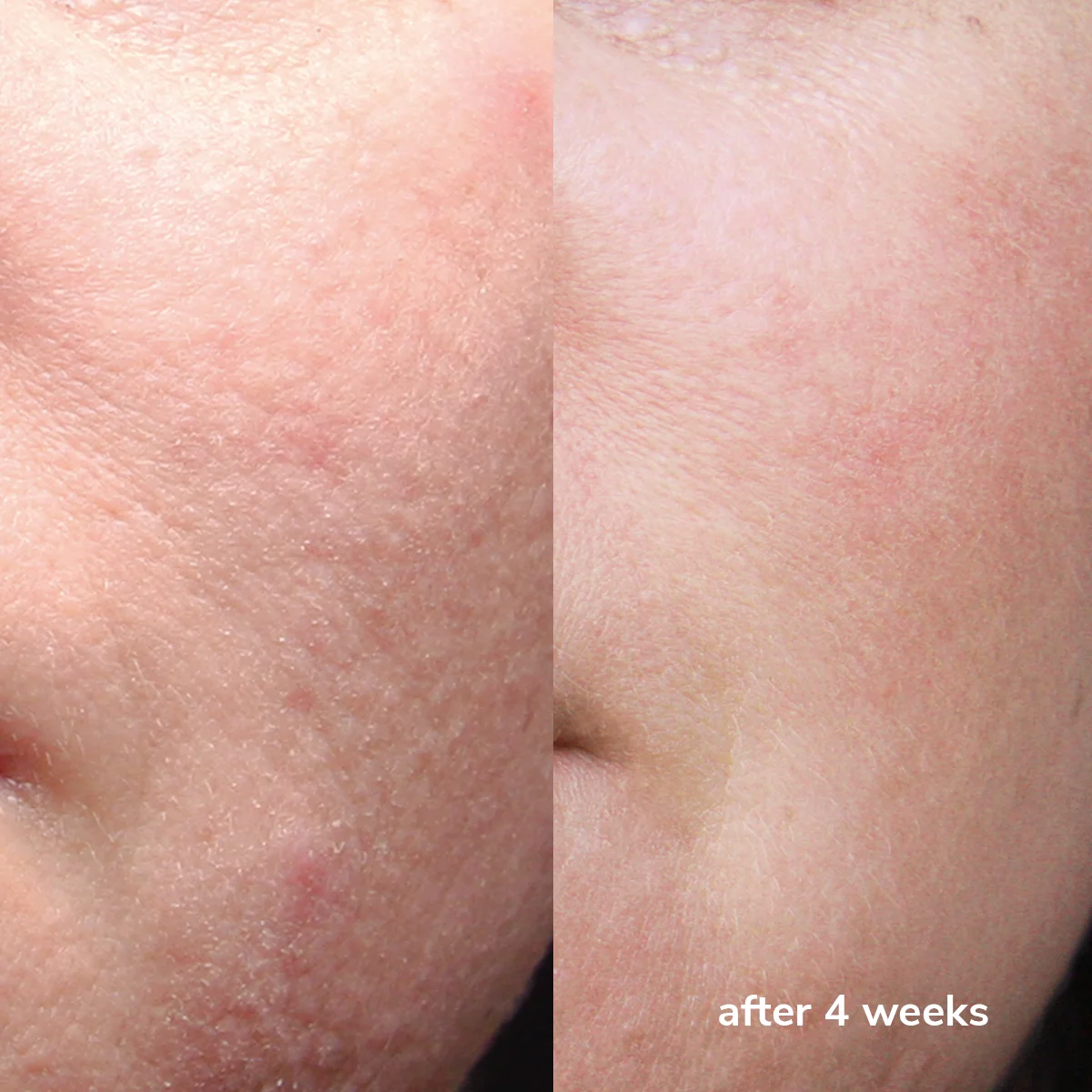 photo - W-Skincare