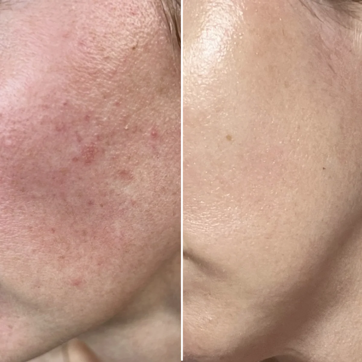 photo - W-Skincare