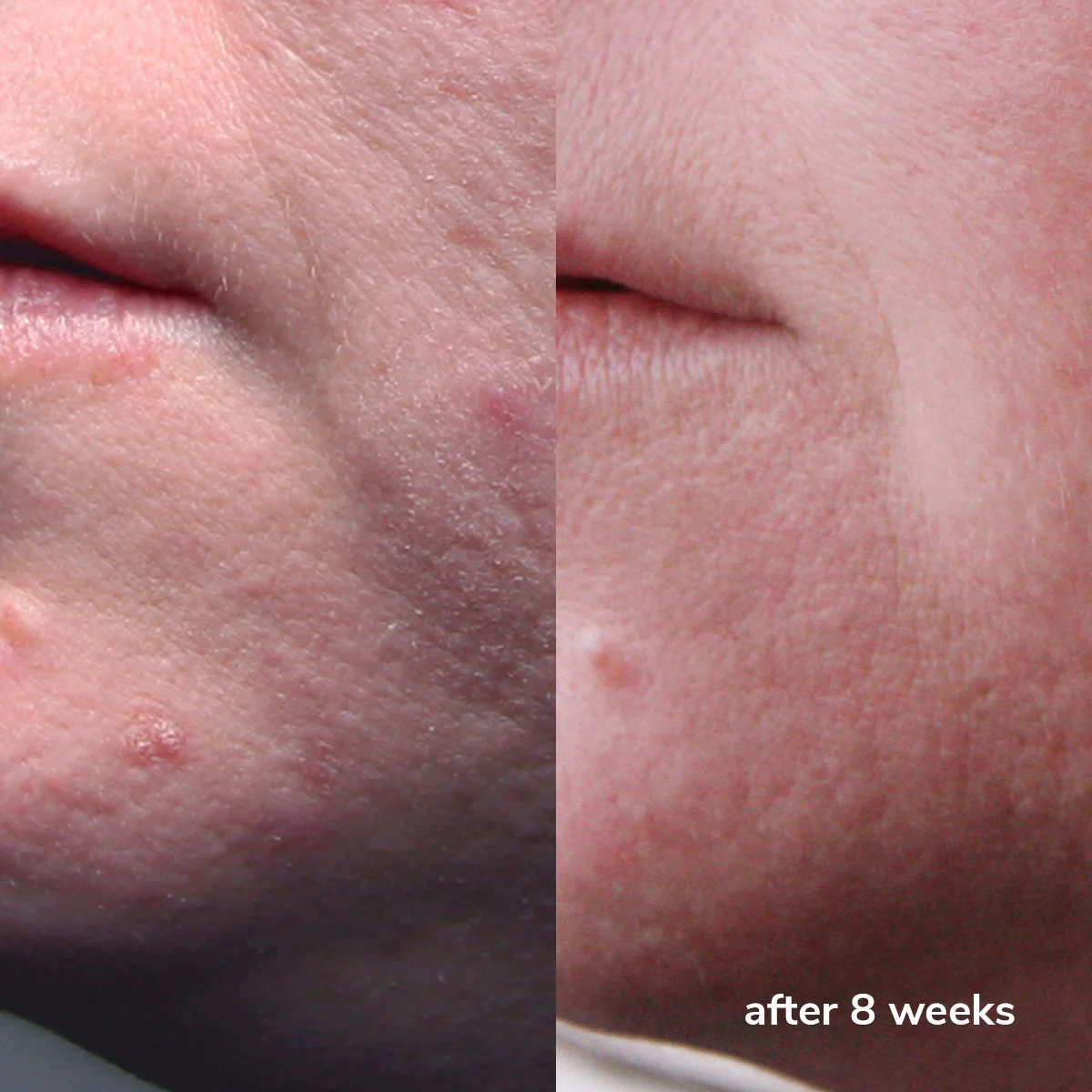 photo - W-Skincare