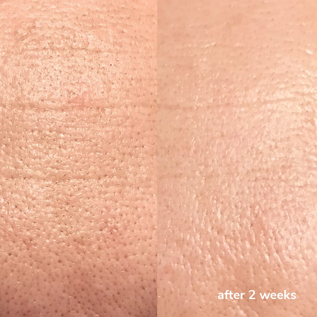 photo - W-Skincare